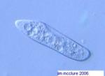 Paramecium